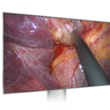 Colonne endoscopie 4k - Image 8